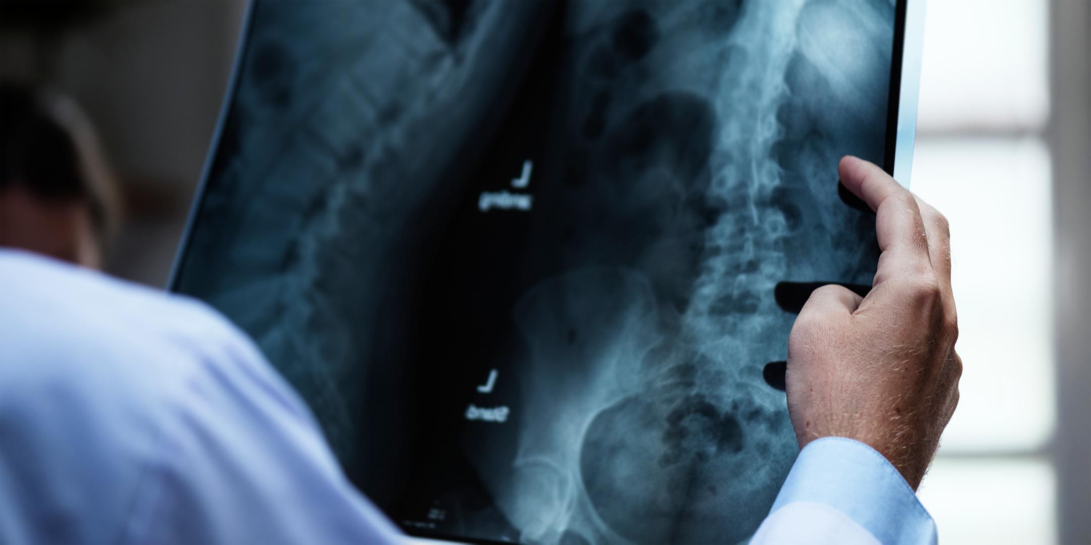 Radiología intervencionista Granada